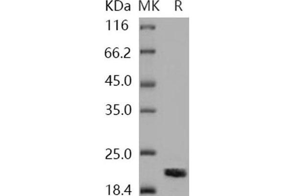 NME1 Protein (His tag)