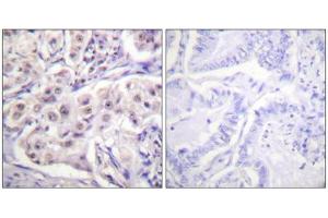 Immunohistochemistry (IHC) image for anti-Heterogeneous Nuclear Ribonucleoprotein D (HNRNPD) (Ser83) antibody (ABIN1848048)