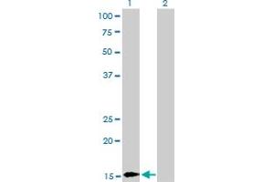 Western Blot analysis of BATF expression in transfected 293T cell line by BATF monoclonal antibody (M03), clone 1G4. (BATF antibody  (AA 34-125))