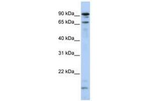 Image no. 1 for anti-Male-Specific Lethal 2 Homolog (MSL2) (N-Term) antibody (ABIN6740807) (MSL2 antibody  (N-Term))