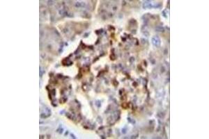 Immunohistochemistry analysis in formalin fixed and paraffin embedded human pancreas tissue reacted with GAD2 / GAD65 Antibody (Center) followed by peroxidase conjugation of the secondary antibody and DAB staining.