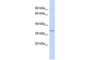 Image no. 1 for anti-Ret Finger Protein-Like 4B (RFPL4B) (AA 151-200) antibody (ABIN6743140) (RFPL4B antibody  (AA 151-200))