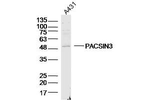 A431 lysates probed with PACSIN3 Polyclonal Antibody, Unconjugated  at 1:300 dilution and 4˚C overnight incubation. (PACSIN3 antibody  (AA 251-350))