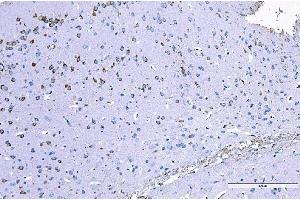 IHC analysis of RALBP1 using anti-RALBP1 antibody (ABIN7600800).