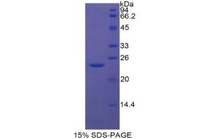 SDS-PAGE analysis of Rat Insulin Like Growth Factor Binding Protein 6 (IGFBP6) Protein.