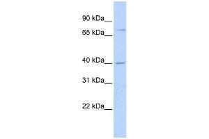 WB Suggested Anti-RHPN1 Antibody Titration: 0. (RHPN1 antibody  (Middle Region))