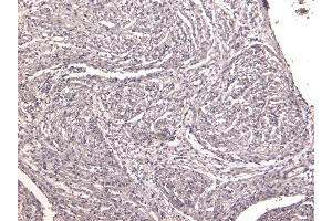 (ABIN570994) Negative Control showing staining of paraffin embedded Human Heart, with no primary antibody. (NK2 Homeobox 5 antibody  (Internal Region))