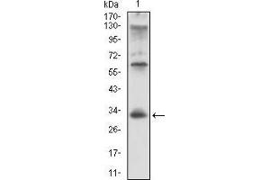 Western Blotting (WB) image for anti-HLA-DR-gamma (CD74) (AA 1-106) antibody (ABIN1724870)