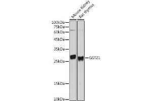 Western blot analysis of extracts of various cell lines, using GSTZ1 antibody (ABIN6132376, ABIN6141485, ABIN6141486 and ABIN6221727) at 1:500 dilution. (GSTZ1 antibody  (AA 1-216))