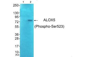 Western blot analysis of extracts from JK cells (Lane 2), using ALOX5 (Phospho-Ser523) Antibody. (ALOX5 antibody  (pSer523))