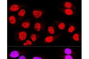 Confocal immunofluorescence analysis of U-2 OS cells using TEAD3 Polyclonal Antibody at dilution of 1:400.