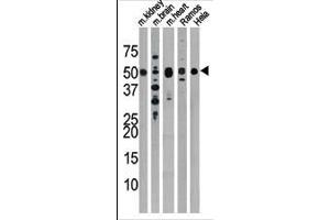 The anti-Drosophila Parkin Pab (ABIN390387 and ABIN2850546) is used in Western blot to detect Drosophila Parkin in, from left to right, mouse kidney, mouse brain, mouse heart, Ramos, and Hela tissue lysates. (Parkin antibody  (N-Term))