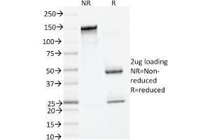 SDS-PAGE Analysis Purified Tryptase Mouse Monoclonal Antibody (TPSAB1/1961). (TPSAB1 antibody  (AA 115-233))