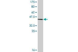 Western Blot detection against Immunogen (46. (RAC2 antibody  (AA 1-192))