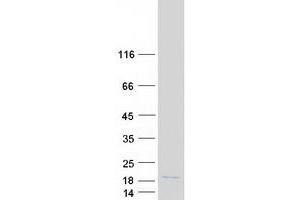 HIST1H2AC Protein (Myc-DYKDDDDK Tag)