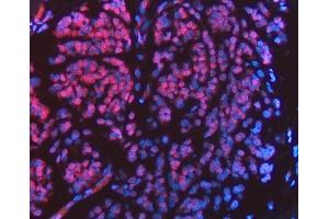 IF analysis of FIP1L1 using anti-FIP1L1 antibody (ABIN7600761). (FIP1L1 antibody  (AA 23-558))
