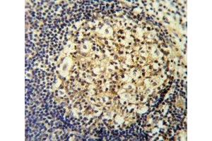 CCR7 antibody IHC analysis in formalin fixed and paraffin embedded human tonsil. (CCR7 antibody  (AA 11-37))