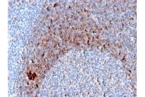 Formalin-fixed, paraffin-embedded human Tonsil stained with CD79b Mouse Monoclonal Antibody (B29/123). (CD79b antibody  (C-Term))