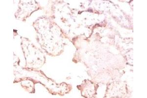 Immunohistochemistry of paraffin-embedded human placenta tissue using ABIN7166803 at dilution of 1:50 (FTSJ1 antibody  (AA 1-329))