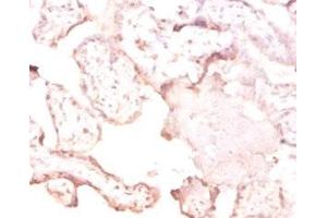 Immunohistochemistry of paraffin-embedded human placenta tissue using ABIN7166803 at dilution of 1:50 (FTSJ1 antibody  (AA 1-329))