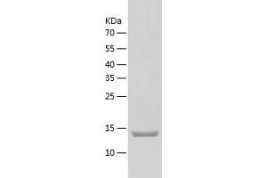 Western Blotting (WB) image for Glial Cell Line Derived Neurotrophic Factor (GDNF) (AA 78-211) protein (His tag) (ABIN7286248) (GDNF Protein (AA 78-211) (His tag))