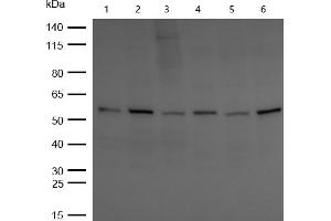 All lanes : CBX2 Rabbit mAb at 1/1k dilution Lane 1 : Hela whole cell lysates Lane 2 : SH-SY5Y whole cell lysates Lane 3 : MCF7 whole cell lysates Lane 4 : 3T3 whole cell lysates Lane 5 : C6 whole cell lysates Lane 6 : Rat Brain lysates Lysates/proteins at 20 μg per lane. (Recombinant CBX2 antibody)