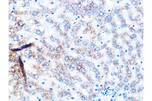 Immunohistochemistry of paraffin-embedded rat liver using NDUFS3 Rabbit mAb (ABIN7268820) at dilution of 1:100 (40x lens). (NDUFS3 antibody)
