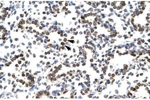 Human Lung; ZNF385 antibody - N-terminal region in Human Lung cells using Immunohistochemistry
