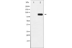 Western blot analysis of IKK- alpha phosphorylation expression in EGF treated MDA-MB-435 whole cell lysates,The lane on the left is treated with the antigen-specific peptide.