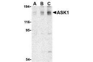 Western blot analysis of ASK1 in SW1353 cell lysate with AP30086PU-N ASK1 antibody at (A) 0. (ASK1 antibody)