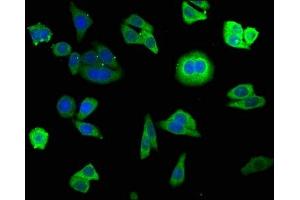 Immunofluorescence staining of HepG2 cells with ABIN7153223 at 1:140, counter-stained with DAPI. (FUOM antibody  (AA 1-134))