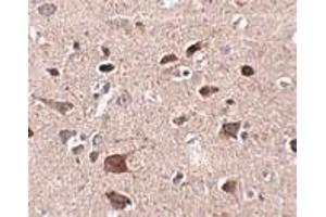 Immunohistochemistry of CCDC134 in human brain tissue with CCDC134 antibody at 2. (CCDC134 antibody  (N-Term))