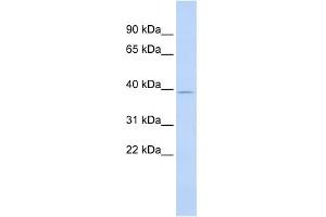 WB Suggested Anti-SAMD8 Antibody Titration: 0. (SAMD8 antibody  (Middle Region))