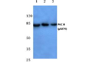 Western blot (WB) analysis of p-PKC ζ antibody at 1/500 dilution (PKC theta antibody  (pSer676))