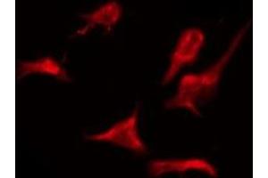 OR2AJ1 antibody