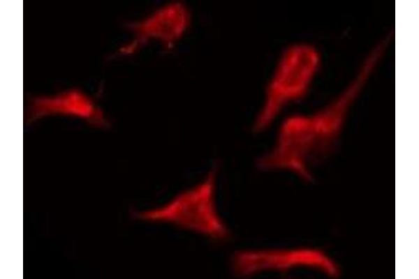 OR2AJ1 antibody