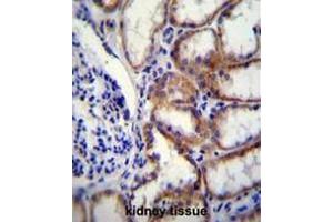COL8A2 Antibody (C-term) immunohistochemistry analysis in formalin fixed and paraffin embedded human kidney tissue followed by peroxidase conjugation of the secondary antibody and DAB staining. (COL8a2 antibody  (C-Term, Chain alpha 2))