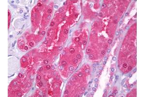Anti-HIP1 antibody IHC of human kidney, tubules. (HIP1 antibody  (AA 928-1038))