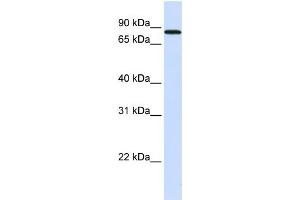 WB Suggested Anti-MAP4K2 Antibody Titration:  0. (MAP4K2 antibody  (N-Term))