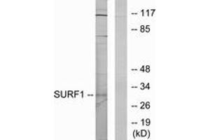 Western blot analysis of extracts from Jurkat cells, using SURF1 Antibody. (SURF1 antibody  (AA 171-220))
