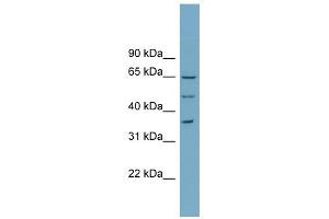 WDR33 antibody used at 1 ug/ml to detect target protein. (WDR33 antibody  (N-Term))