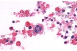Anti-CD97 antibody  ABIN1048418 IHC staining of human bone marrow. (CD97 antibody  (Cytoplasmic Domain))