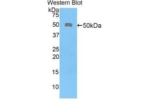 Western blot analysis of the recombinant protein. (CD46 antibody  (AA 136-341))