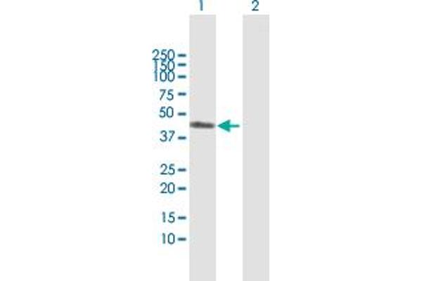ART3 antibody  (AA 1-378)