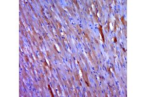 Paraformaldehyde-fixed, paraffin embedded rat muscle; Antigen retrieval by boiling in sodium citrate buffer (pH6. (ATP2A1/SERCA1 antibody  (AA 101-200))