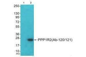 PPP1R2 antibody  (Ser120, Ser121)