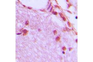 Immunohistochemical analysis of hnRNP H staining in human brain formalin fixed paraffin embedded tissue section. (HNRNPH1 antibody  (Center))