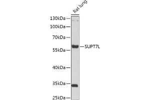Western blot analysis of extracts of Rat lung, using SUPT7L antibody (ABIN7270646) at 1:1000 dilution. (SUPT7L antibody  (AA 210-400))