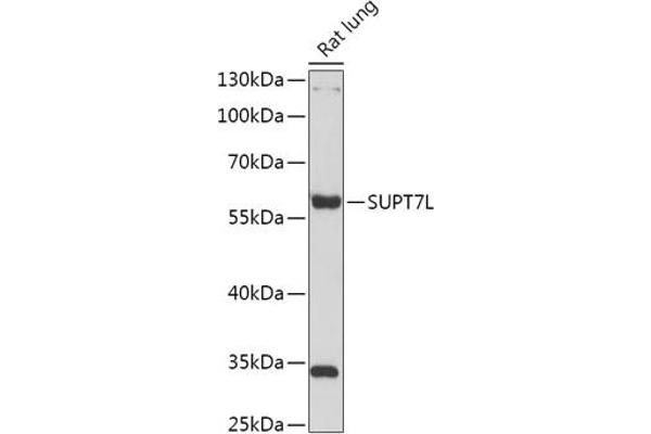 SUPT7L anticorps  (AA 210-400)