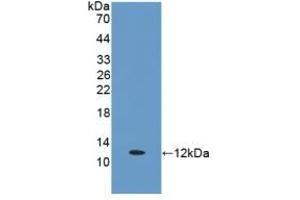 Detection of Recombinant ERb, Human using Polyclonal Antibody to Estrogen Receptor Beta (ERb) (ESR2 antibody  (AA 149-213))